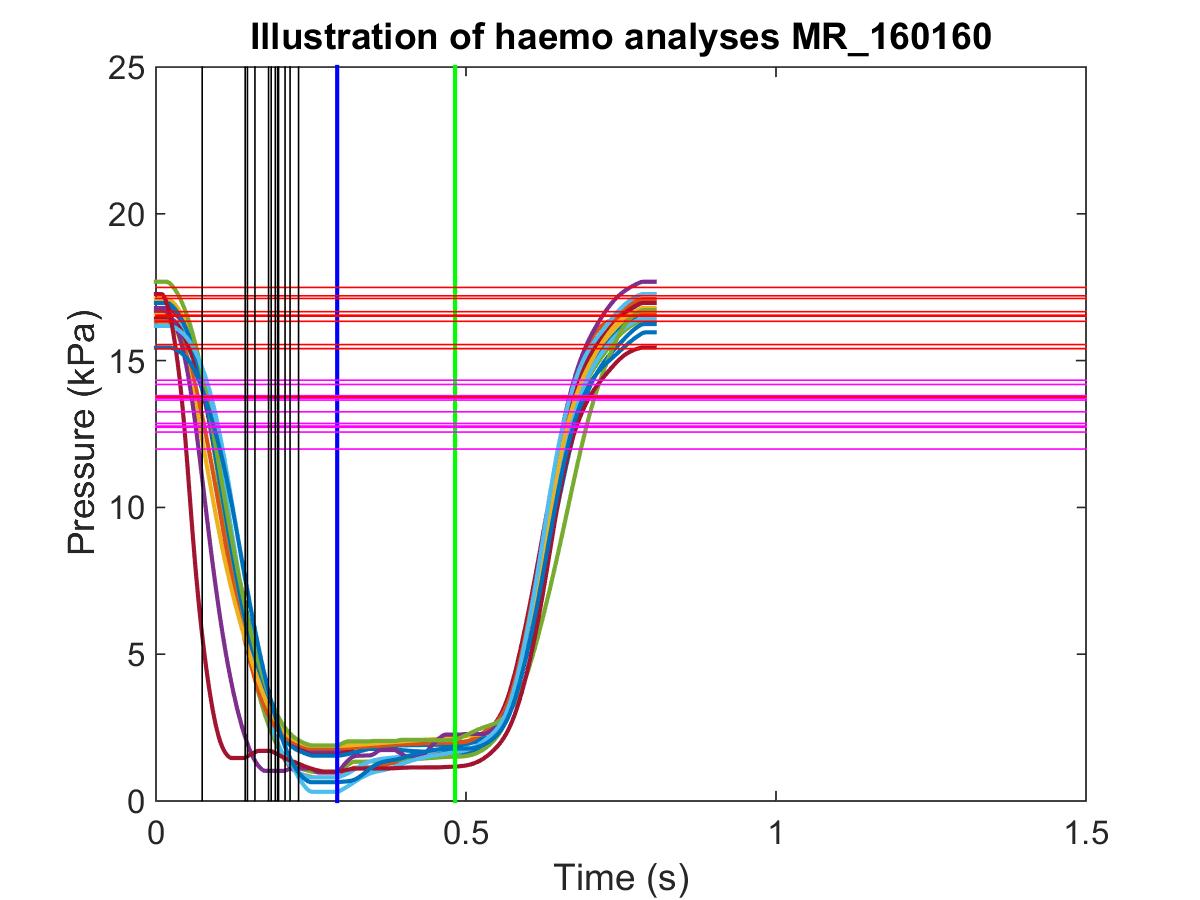 LVP analyses